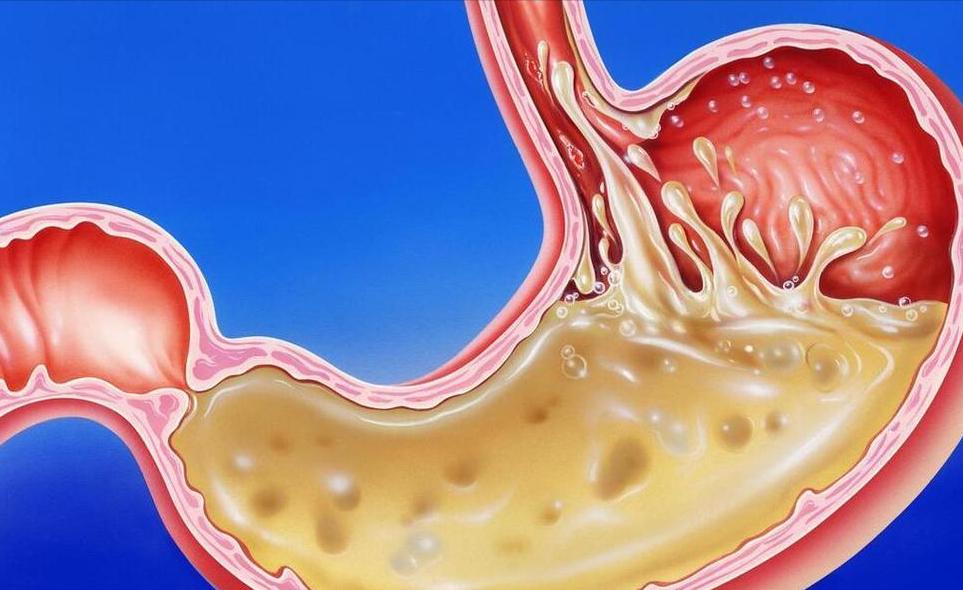 医生：只需几个习惯，胆汁分泌就有可能改善，即使你已到了晚年